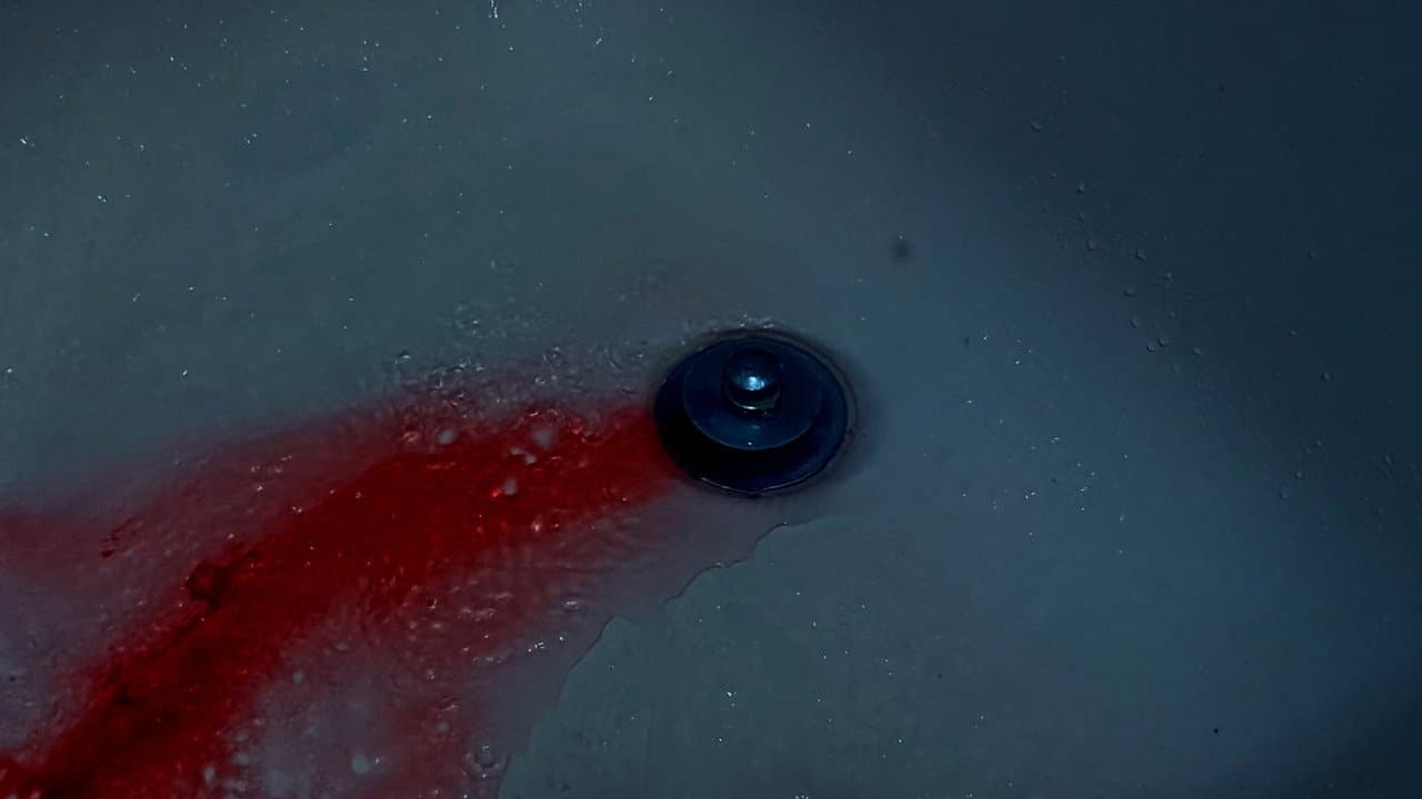 A Bad (Facial) Hair Day